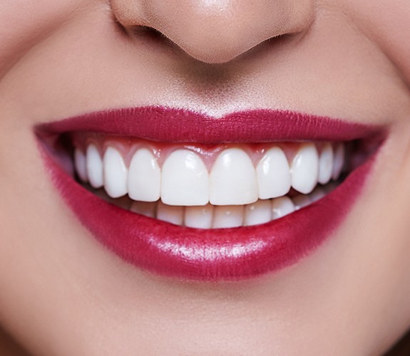 Closeup of beautiful smile after crown lengthening