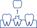 Animated smile with lost dental crown