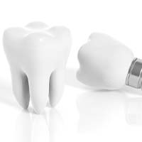 A dental implant and tooth in Lockport