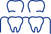 Animated dental implant supported fixed bridge placement