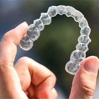 Invisalign aligner in Lockport