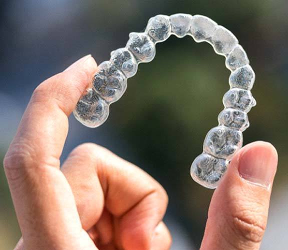 Holding a clear aligner for Invisalign Teen in Lockport, IL