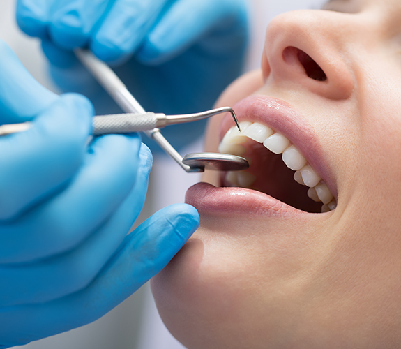 Closeup of patient receiving scaling and root planing periodontal therapy