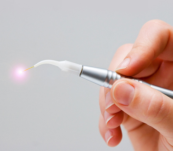 Hand holding soft tissue laser dentistry tool