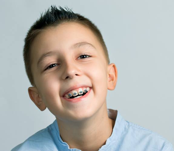 Boy smiles during Phase 1 orthodontic treatment in Lockport, IL