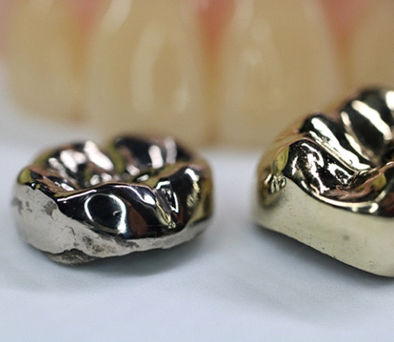 Close-up of stainless steel crowns
