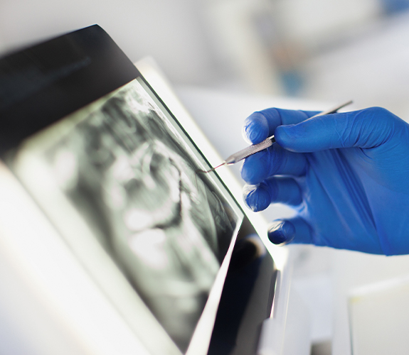 Dentist looking at digital x-rays on chairside computer