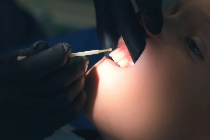 Dentist applying fluoride to a young boy’s teeth