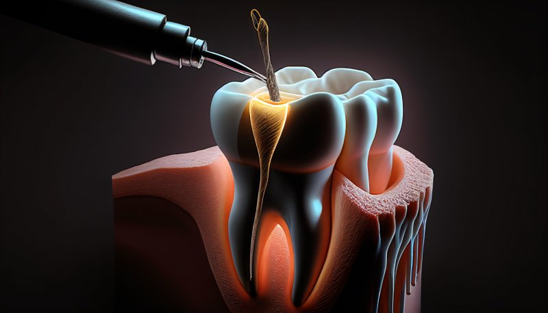 digital image of a root canal
